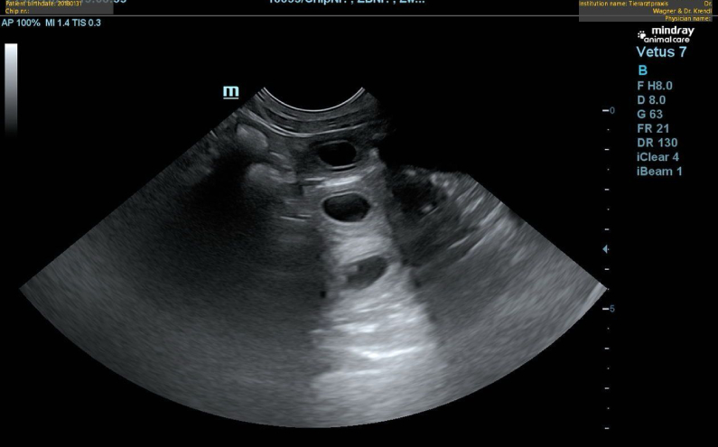 Dwyn is pregnant according to ultrasound